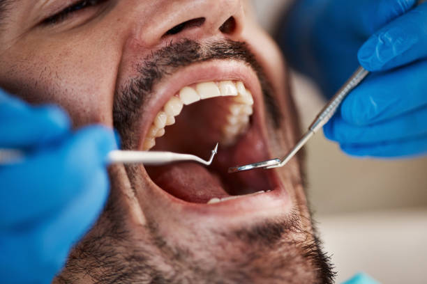 Emergency Dental Care for Trauma or Injury